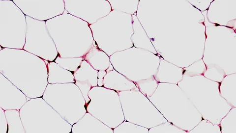 Microscope cross section of adipose tissue