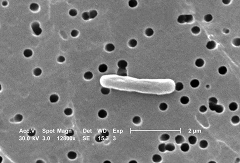 Scanning electron micrograph of Escherichia coli bacteria