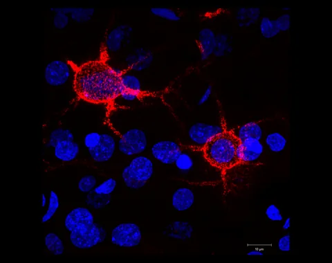 Red perineuronal nets and blue nuclei in mouse brain tissue