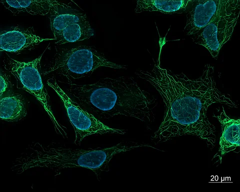 Green-stained filaments and blue nuclei in human-derived cells