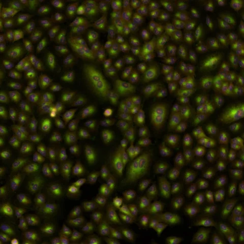 Multicolour Cell Painting fluorescence microscopy of human cells