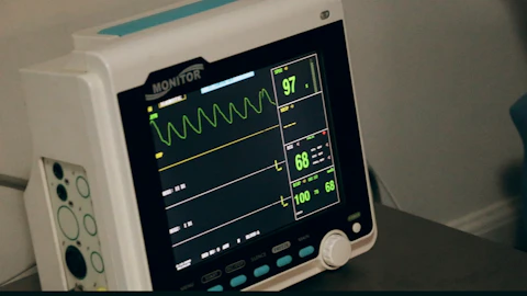 A medical monitor displaying vital signs