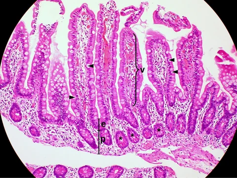 Microscope image of small-intestinal mucosa and villi