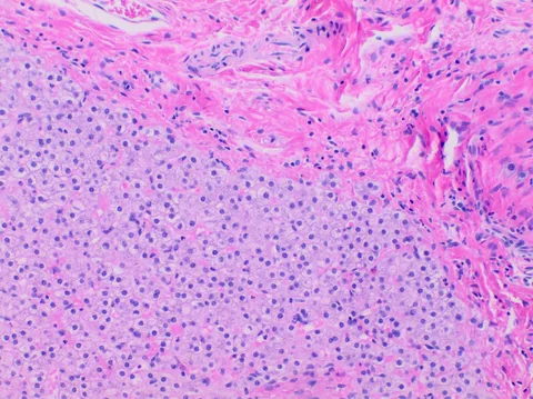Pink-stained liver tissue seen under a microscope