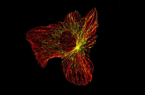 Fluorescence microscopy of a migrating U2OS cancer cell