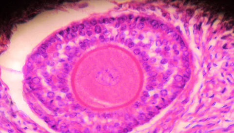 Microscope image of a human primary ovarian follicle