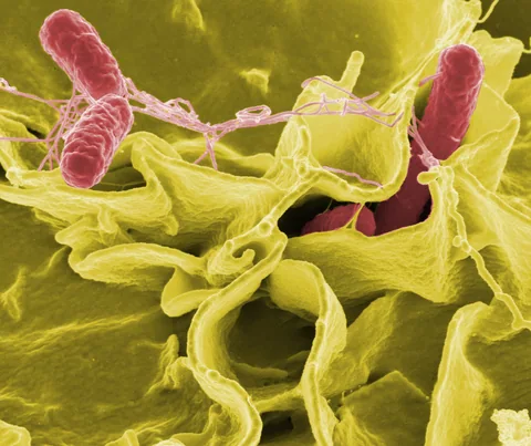 Colour-enhanced electron micrograph of Salmonella bacteria and cultured human cells
